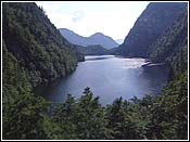ToplitzSee