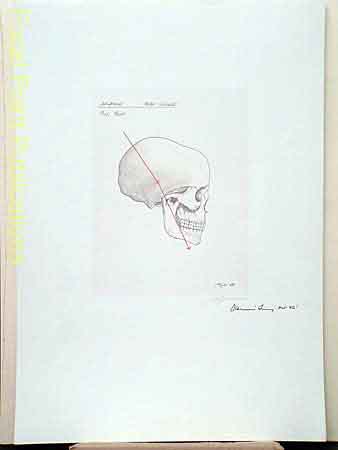KujauLithos041